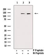 Phospho-JAK1 (Tyr1034) Antibody in Western Blot (WB)