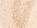 Phospho-GSK3B (Ser9) Antibody in Immunohistochemistry (Paraffin) (IHC (P))