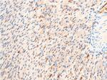 Phospho-GSK3B (Ser9) Antibody in Immunohistochemistry (Paraffin) (IHC (P))