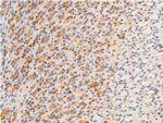 Phospho-GSK3B (Ser9) Antibody in Immunohistochemistry (Paraffin) (IHC (P))