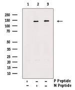 Phospho-ULK1 (Ser317) Antibody in Western Blot (WB)