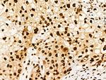 Phospho-RUNX1 (Ser249) Antibody in Immunohistochemistry (Paraffin) (IHC (P))