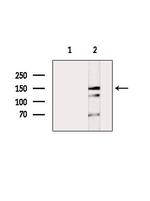 Phospho-AS160 (Ser318) Antibody in Western Blot (WB)
