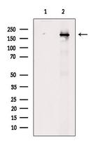 Phospho-BCL9L (Ser915) Antibody in Western Blot (WB)