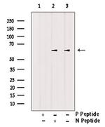 Phospho-CTDSPL2 (Ser104) Antibody in Western Blot (WB)