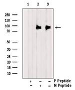 Phospho-DR6 (Ser562) Antibody in Western Blot (WB)