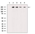 Phospho-EIF4G1 (Ser1147) Antibody in Western Blot (WB)