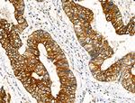 Phospho-FOXO3A (Ser413) Antibody in Immunohistochemistry (Paraffin) (IHC (P))