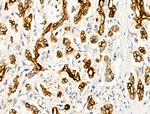 Phospho-FOXO3A (Ser413) Antibody in Immunohistochemistry (Paraffin) (IHC (P))