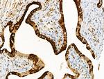 Phospho-FOXO3A (Ser413) Antibody in Immunohistochemistry (Paraffin) (IHC (P))