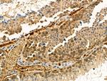 Phospho-FOXO3A (Ser413) Antibody in Immunohistochemistry (Paraffin) (IHC (P))