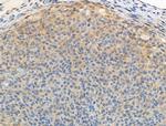 Phospho-FOXO3A (Ser413) Antibody in Immunohistochemistry (Paraffin) (IHC (P))