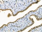 Phospho-FOXO3A (Ser7) Antibody in Immunohistochemistry (Paraffin) (IHC (P))