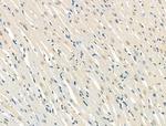 Phospho-FOXO3A (Ser7) Antibody in Immunohistochemistry (Paraffin) (IHC (P))