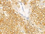 Phospho-GRB10 (Ser476) Antibody in Immunohistochemistry (Paraffin) (IHC (P))