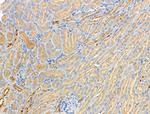 Phospho-GRB10 (Ser476) Antibody in Immunohistochemistry (Paraffin) (IHC (P))