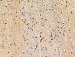 Phospho-MEF2A (Ser408) Antibody in Immunohistochemistry (Paraffin) (IHC (P))