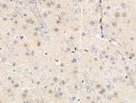 Phospho-MEF2A (Ser408) Antibody in Immunohistochemistry (Paraffin) (IHC (P))