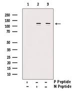 Phospho-NEDD4L (Ser448) Antibody in Western Blot (WB)