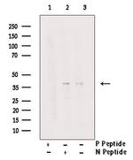 Phospho-NPM1 (Thr95) Antibody in Western Blot (WB)