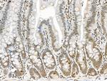 Phospho-NuMA (Ser395) Antibody in Immunohistochemistry (Paraffin) (IHC (P))