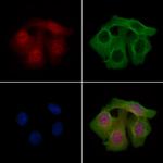 Phospho-PAK2 (Ser20) Antibody in Immunocytochemistry (ICC/IF)