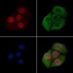 Phospho-PLK1 (Thr210) Antibody in Immunocytochemistry (ICC/IF)