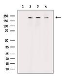 Phospho-RICTOR (Thr1135) Antibody in Western Blot (WB)