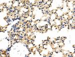 Phospho-SHIP2 (Tyr1135) Antibody in Immunohistochemistry (Paraffin) (IHC (P))