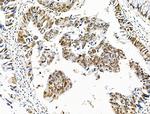 Phospho-SKP2 (Ser64) Antibody in Immunohistochemistry (Paraffin) (IHC (P))