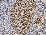 Phospho-SKP2 (Ser64) Antibody in Immunohistochemistry (Paraffin) (IHC (P))