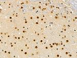 Phospho-SKP2 (Ser64) Antibody in Immunohistochemistry (Paraffin) (IHC (P))