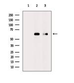 Phospho-SQSTM1 (Thr269, Ser272) Antibody in Western Blot (WB)