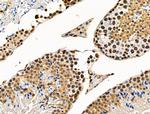 Phospho-SRC3 (Thr24) Antibody in Immunohistochemistry (Paraffin) (IHC (P))