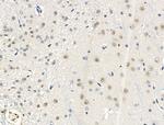 Phospho-SSH3 (Ser37) Antibody in Immunohistochemistry (Paraffin) (IHC (P))