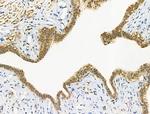 Phospho-TBC1D1 (Ser237) Antibody in Immunohistochemistry (Paraffin) (IHC (P))