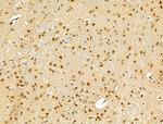 Phospho-TBC1D1 (Ser237) Antibody in Immunohistochemistry (Paraffin) (IHC (P))