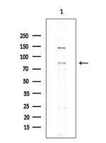 Phospho-MECP2 (Ser80) Antibody in Western Blot (WB)