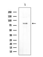 Phospho-MECP2 (Ser80) Antibody in Western Blot (WB)
