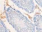 Phospho-Chk1 (Ser301) Antibody in Immunohistochemistry (Paraffin) (IHC (P))