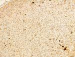 Phospho-IKK beta (Tyr188) Antibody in Immunohistochemistry (Paraffin) (IHC (P))