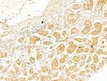 Phospho-IKK beta (Tyr188) Antibody in Immunohistochemistry (Paraffin) (IHC (P))