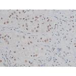 Phospho-IKK alpha/beta (Ser180, Ser181) Antibody in Immunohistochemistry (Paraffin) (IHC (P))