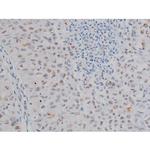 Phospho-IKK alpha/beta (Ser180, Ser181) Antibody in Immunohistochemistry (Paraffin) (IHC (P))