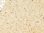 Phospho-IKK alpha/beta (Ser176, Ser177) Antibody in Immunohistochemistry (Paraffin) (IHC (P))