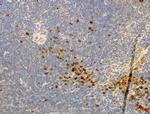 Phospho-IKK alpha/beta (Ser176, Ser177) Antibody in Immunohistochemistry (Paraffin) (IHC (P))