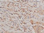 Phospho-IKK alpha/beta (Ser176, Ser177) Antibody in Immunohistochemistry (Paraffin) (IHC (P))