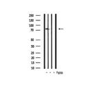 Phospho-IKK alpha/beta (Ser176, Ser177) Antibody in Western Blot (WB)