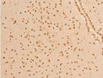 Phospho-p73 (Tyr99) Antibody in Immunohistochemistry (Paraffin) (IHC (P))