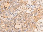 Phospho-p73 (Tyr99) Antibody in Immunohistochemistry (Paraffin) (IHC (P))